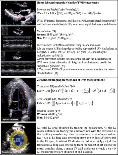 2d echo interpretation